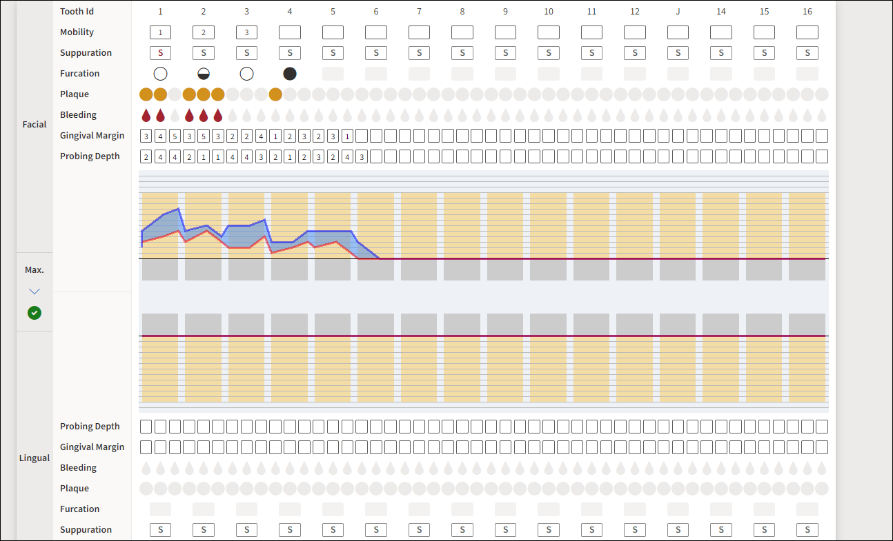 Completed Perio exam Chart  